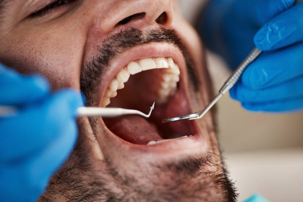 Best Emergency Treatment for Dental Infections or Abscesses in Shaw Heights, CO